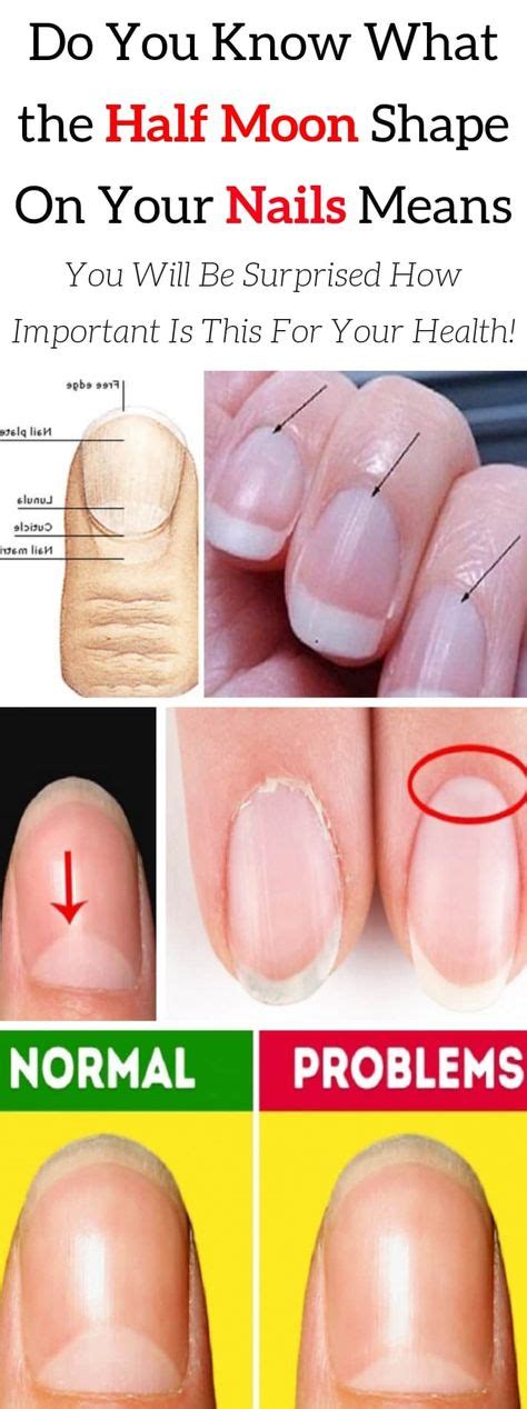 If you look at your fingers from the side, the whites of the nails shouldn't be so long that they start to divorce the rounded shape of the finger. Do You Know What the Half Moon Shape On Your Nails Means ...
