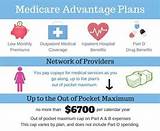Compare Medigap To Medicare Advantage Plans Pictures
