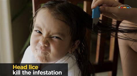 Head Lice Facts And Myths Youtube
