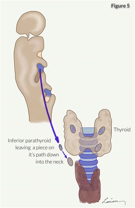 Parathyroid Anatomy Image 7 Hyperparathyroidism Surgery Dr Babak