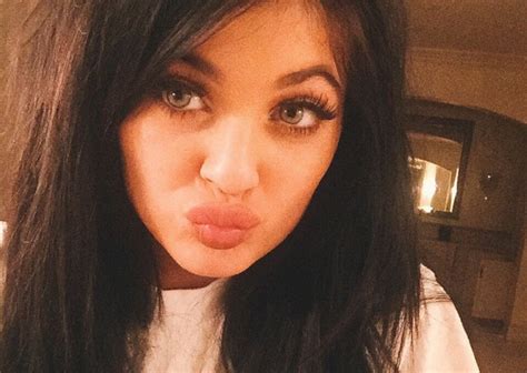 Teenagers Are Sucking Shot Glasses To Get Lips Like Kylie Jenner And