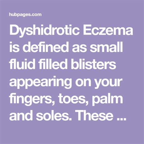 Treating Dyshidrotic Eczema Eczema Blister Remedies Intense Itching