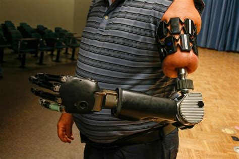 Scientia Potentia Est Advanced Prosthetic Robot Arm The Free Solution