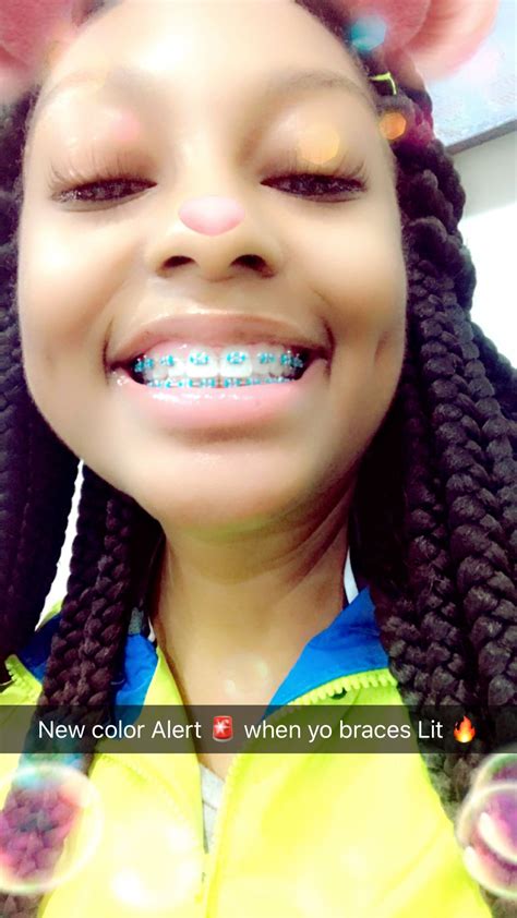 Like What You See Follow Me Pin Iijasminnii Give Me More Board Ideass Cute Braces Colors