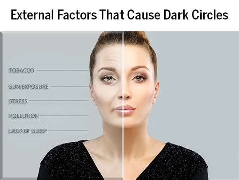 How To Lighten Dark Circles Without Makeup Saubhaya Makeup