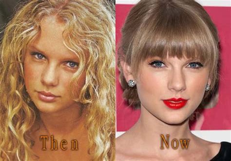 Taylor Swift Plastic Surgery Before And After Vrogue Co