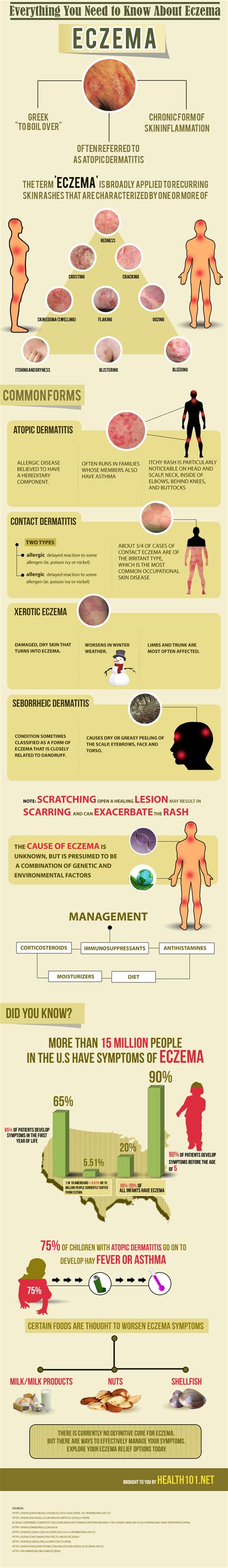 Everything You Need To Know About Eczema Infographic