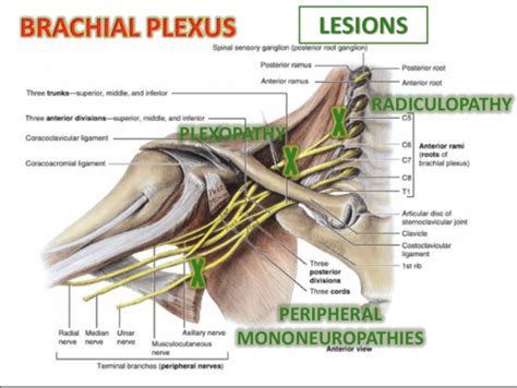 Brachial Plexus Injuries Flashcards Quizlet