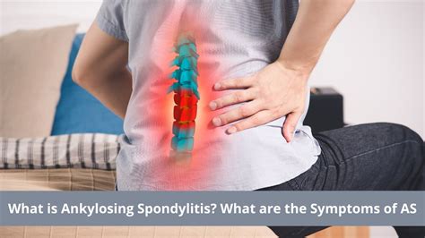 What Is Ankylosing Spondylitis Types Symptoms Causes And Treatment