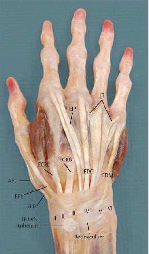 15 Extensor Tendon Injury Repair And Reconstruction Plastic Surgery Key