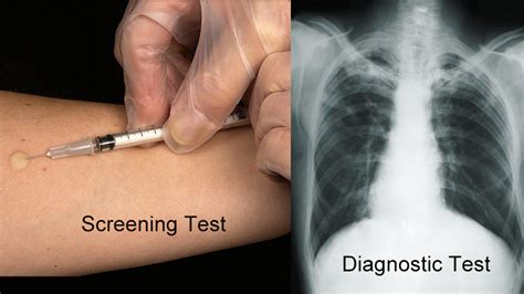 Screening Versus Diagnostic Tests For Covid 19 Whats The Difference