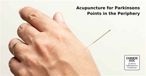 How To Acupuncture For Parkinsons 4 Categories Of Points