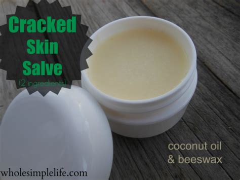 Skin Salve Beeswax Recipe Besto Blog