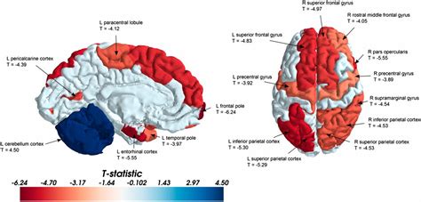 Role Of Genetics In Development Of Sex Differences In The Brain Online
