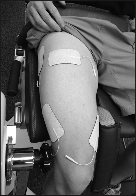 Assessment Of Comfort During Nmes Induced Quadriceps Contractions At