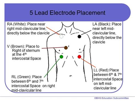 12 Lead Ecg Placement Medical Assistant Student Medical Assistant