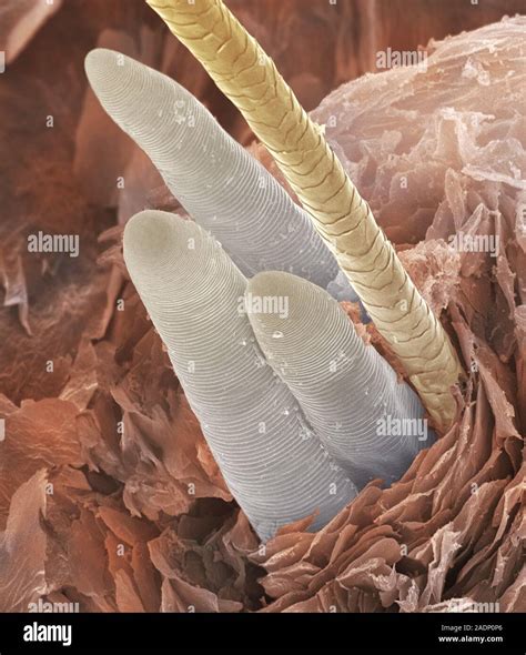 Eyelash Mite Tails Coloured Scanning Electron Micrograph Sem Of The