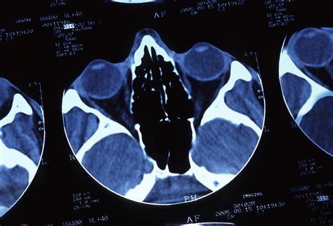 Free Stock Image Of Ct Scan