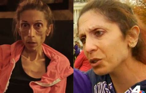 Rachel Farrokh O Cómo Superar La Anorexia Internacional El Mundo