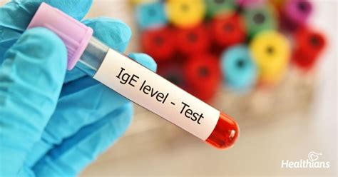 Know Whether You Are Allergic Or Not With The Total Ige Antibody Test