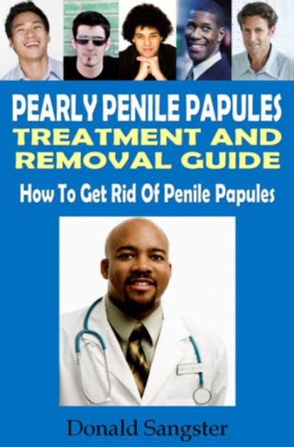 Pearly Penile Papules Treatment And Removal Guide By Donald Sangster