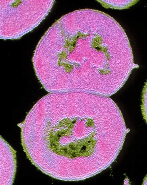 Fcol Tem Of Streptococcus Viridans Photograph By Cnri