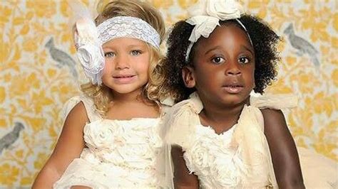 These Twins Skin Colors Varied When They Were Born See How They