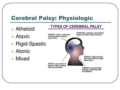 Ppt Cerebral Palsy Brain Paralysis Powerpoint Presentation Free
