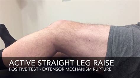 Extensor Mechanism Active Slr Test Youtube