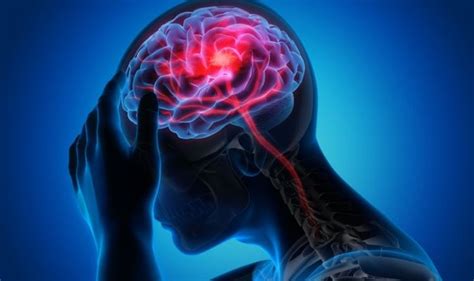 Doctors In Canada Investigate Mystery Brain Disease 48 Cases