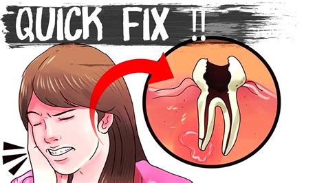 Guide the child to hold a small. How to Cure / Get Rid of Tooth Pain ( TOOTHACHE ) * QUICK ...