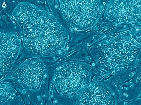 Human Egg Cells Can Be Grown In Lab From Stem Cells Study