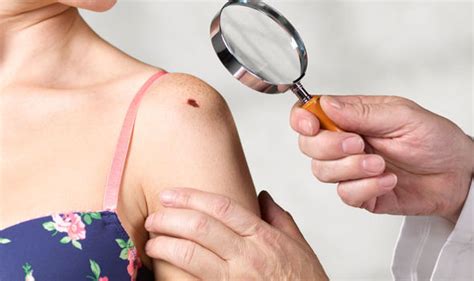 Skin Cancer Symptoms Countries With Highest Risk Of Signs Uk Makes