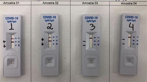 The testing procedure and payment reimbursement conditions described below do not apply to this. Laboratório nacional produz testes para detectar Covid-19 na tentativa de driblar a sub ...