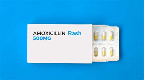 Everything You Need To Know About An Amoxicillin Rash Umedoc
