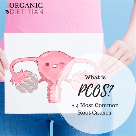 Ever heard of polycystic ovary syndrome (pcos)? What is PCOS + The 4 Most Common Root Causes - The Organic ...