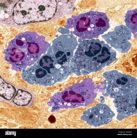 Neutrophil White Blood Cells Coloured Transmission Electron Micrograph