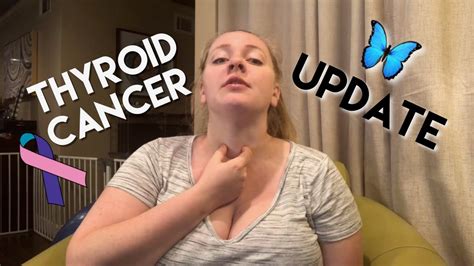 Update On Thyroid Cancer Situation YouTube