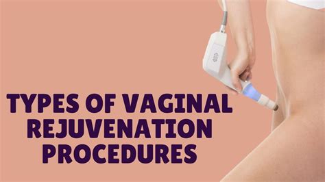 Types Of Vaginal Rejuvenation Procedures Los Angeles Youtube