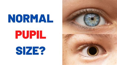 Are Your Pupils Normal Size Youtube