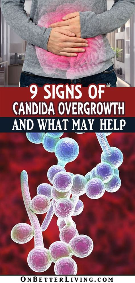 9 Signs Candida Is Wreaking Havoc On Your Body Better Living