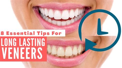 Long Lasting Veneers⏳ Follow This Tips Essential Tips To Take Care