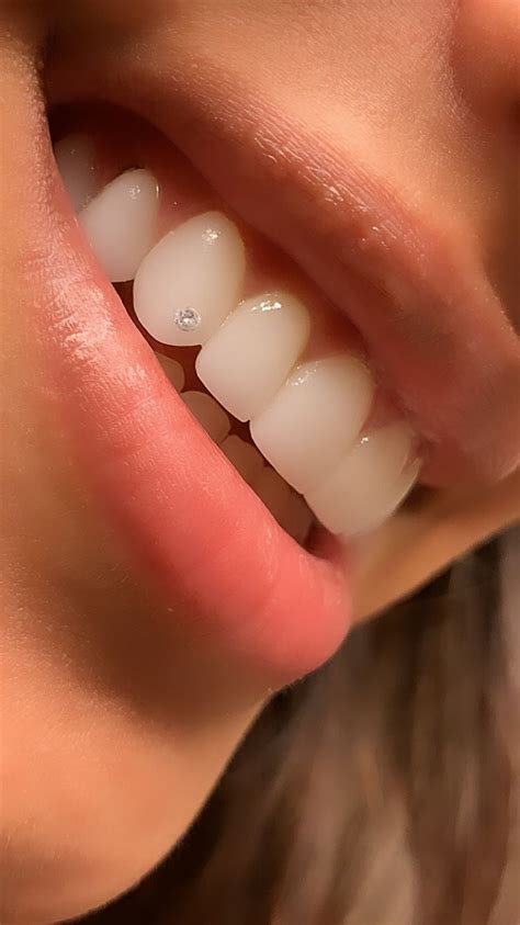 Tooth Jewel Dental Jewelry Teeth Jewelry Pretty Teeth