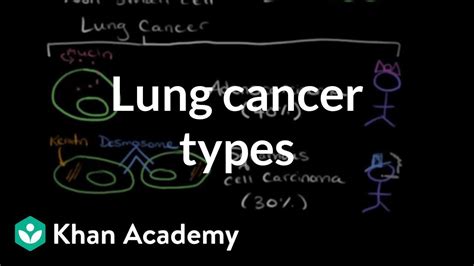 Other types of lung cancer and benign growths. Lung cancer types | Respiratory system diseases | NCLEX-RN ...