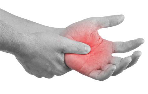 Is Your Hand Pain Carpal Tunnel Syndrome Cona