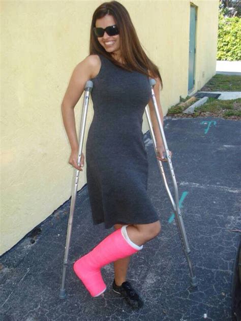 Leg Cast Leg Cast Plaster Cast Crutches Broken Leg Fabulous Quick Gypsum Crutch Broken Foot