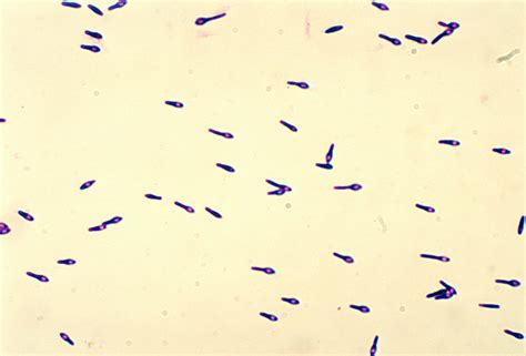 フリー写真画像 7 種類ボツリヌス中毒毒素指定文字 種類 病気
