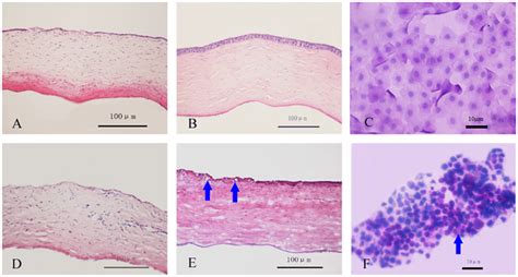 Corneal H And E Staining And Impression Cytology After Transplantation
