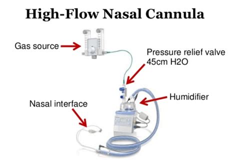 The nasal cannula (nc) is a device used to deliver supplemental oxygen or increased airflow to a patient or person in need of respiratory help. emDOCs Team on Twitter: "Looking for a Better Way to Treat ...