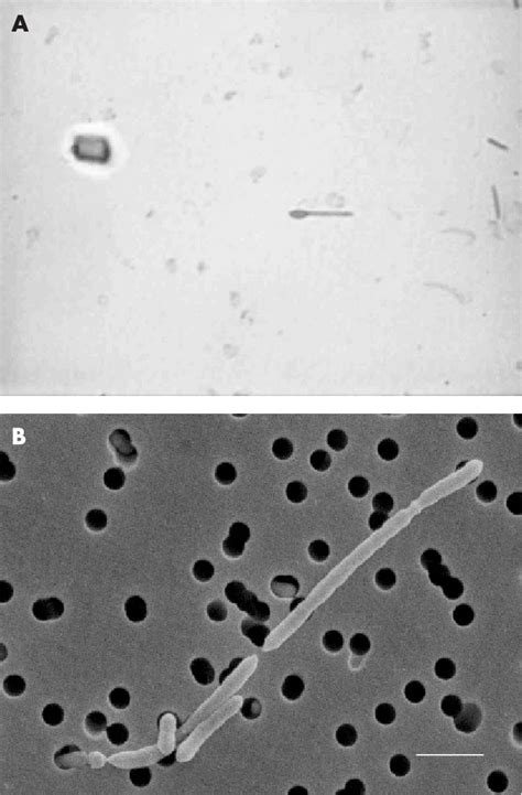 Spore Stain Of Hku19 A Showing Terminal Spores Green With A